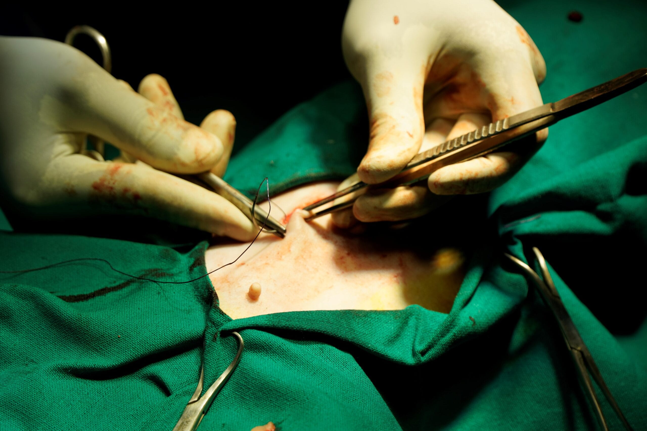 Veterinary surgeon performing orthopaedic surgery at The Jupiter Pet Hospital Hyderabad